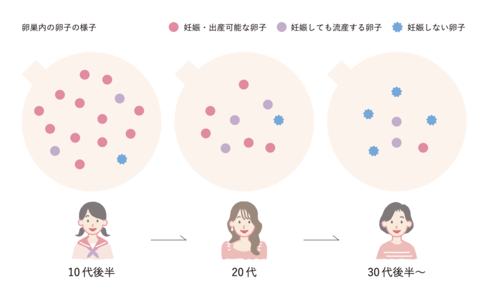 婦人科イカデン卵子のリーフレット