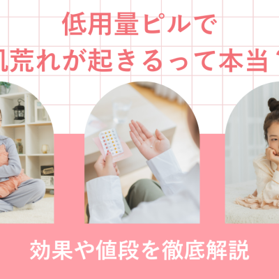 低用量ピルで肌荒れが起きるって本当？効果や値段を徹底解説