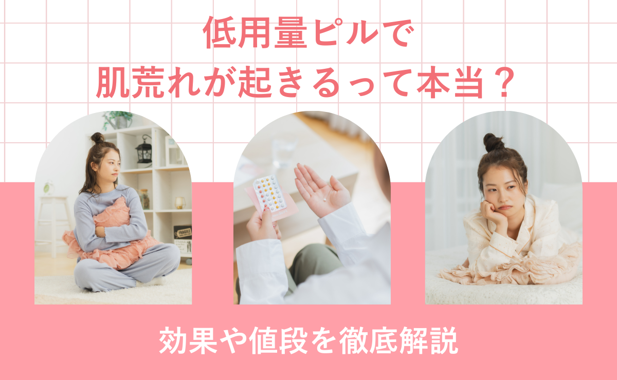 低用量ピルで肌荒れが起きるって本当？効果や値段を徹底解説